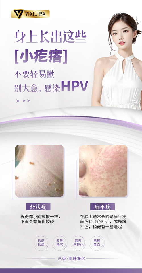 已秀减肥店的利润 新疆减肥加盟费