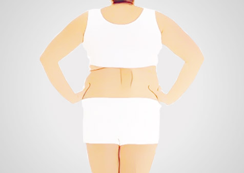 留纤减肥 加盟店的经营策略